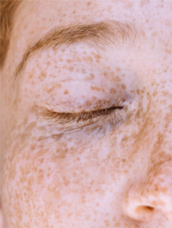 Fade Dark Spots & Glow in Days Vitamin C Serum - Skin Care | Nuvessa Skincare